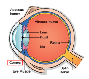 Bacterial Corneal Infections (Keratitis)