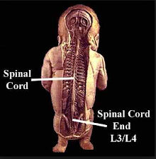 Chiropractor Baby 2