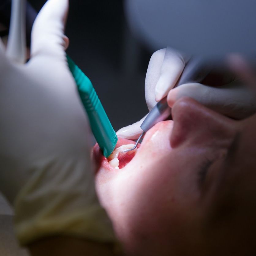 root canals in Coleman, TX