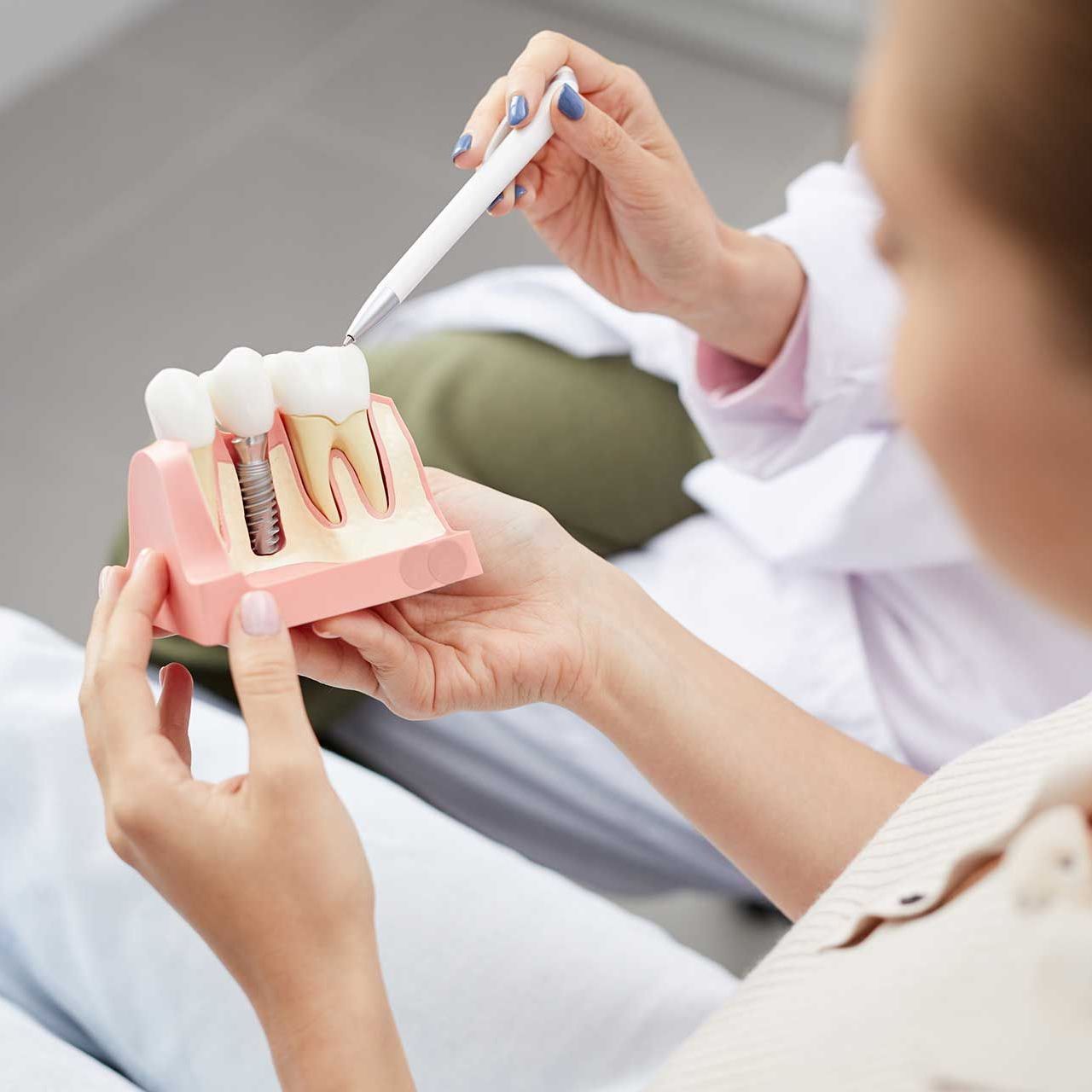 High angle view of unrecognizable young woman holding tooth model during consultation in dentists office, 
