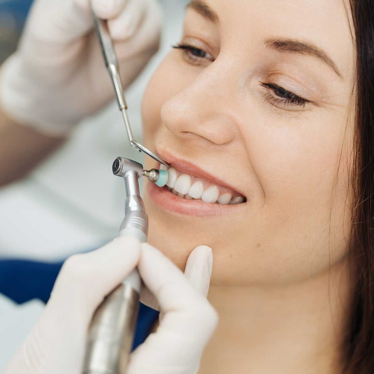 Overview of dental caries prevention. Girl at the dentist chair during a dental scaling procedure. Healthy Smile.