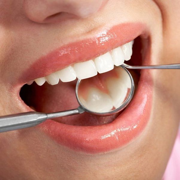 Tooth Extraction | Brownwood, TX