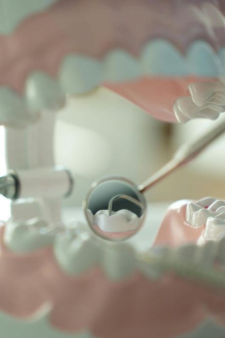 Dental mirror reflecting teeth during a dental exam