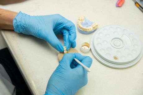 Gloved hands working on a dental mold beside a tray of dental materials