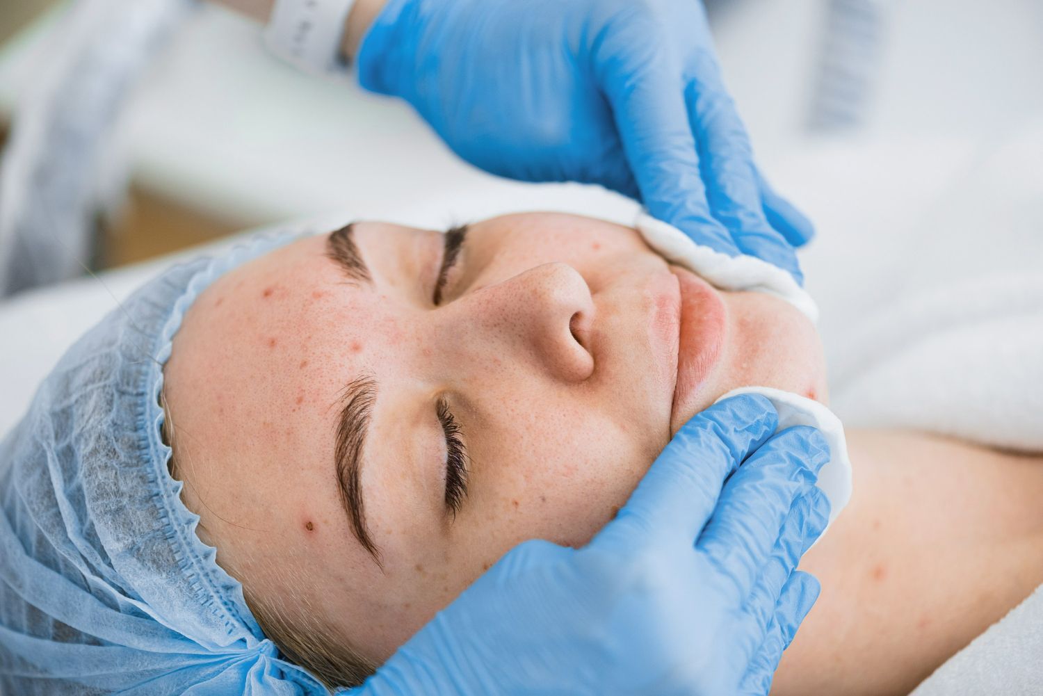 A professional applying skincare to a person's face with cotton pads, wearing blue medical gloves in a spa setting.