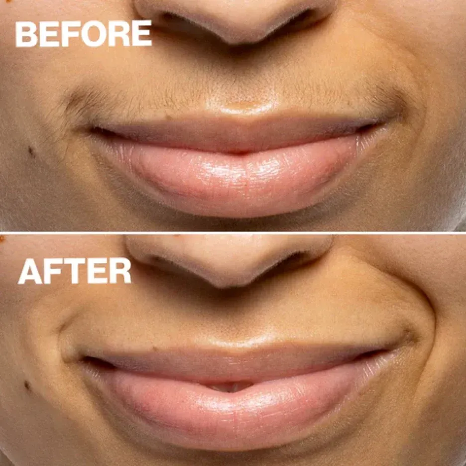 A before and after picture of a woman 's lips.