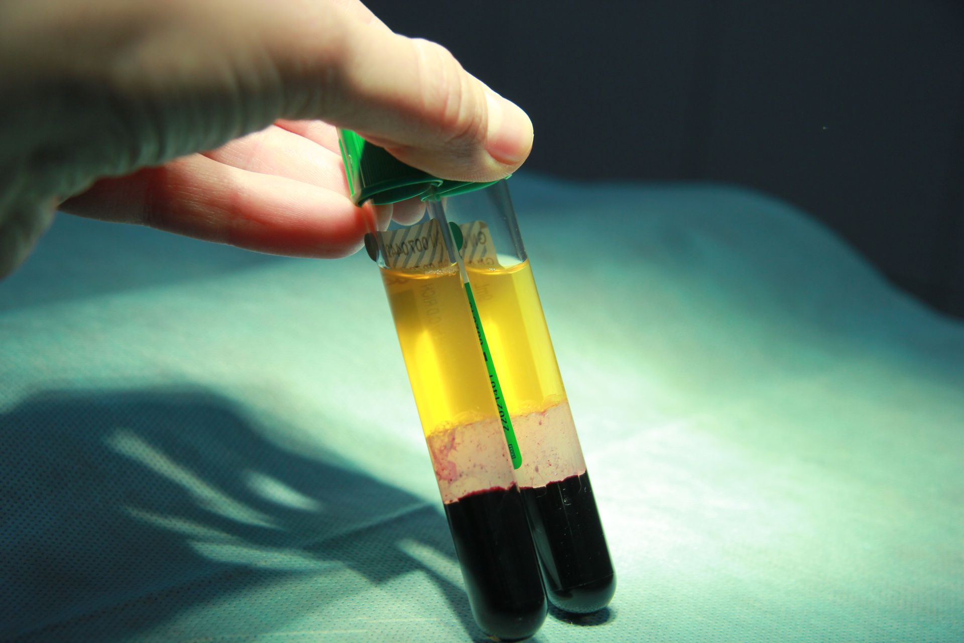 A person is holding a test tube filled with yellow liquid and black liquid
