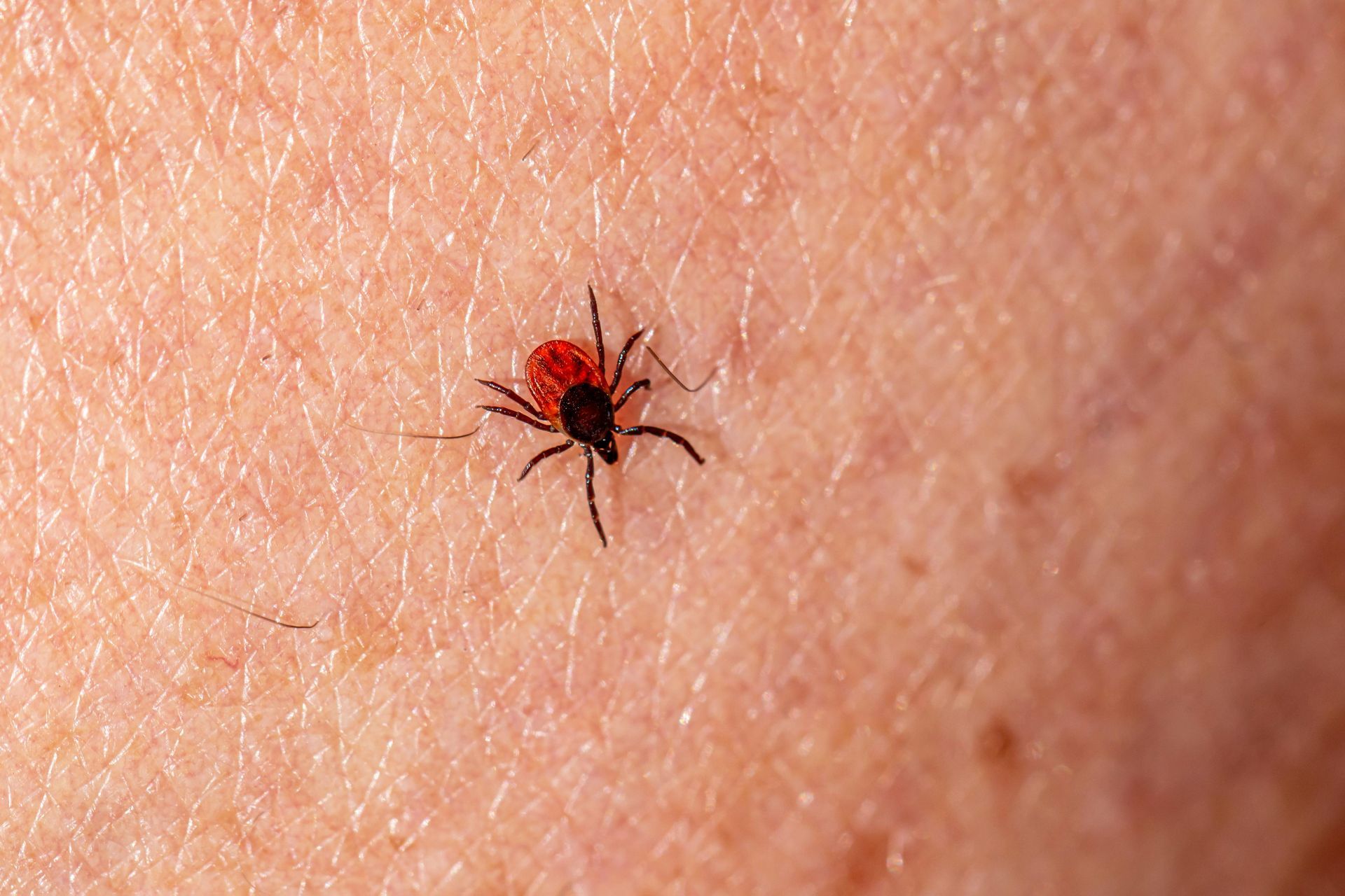 Red tick on human skin