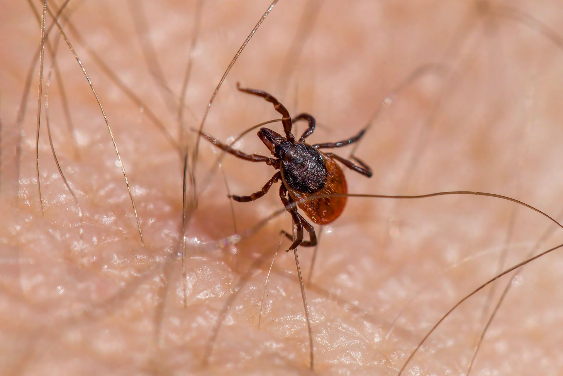 Close-up of a tick on human skin, showing a black body and reddish-brown abdomen.