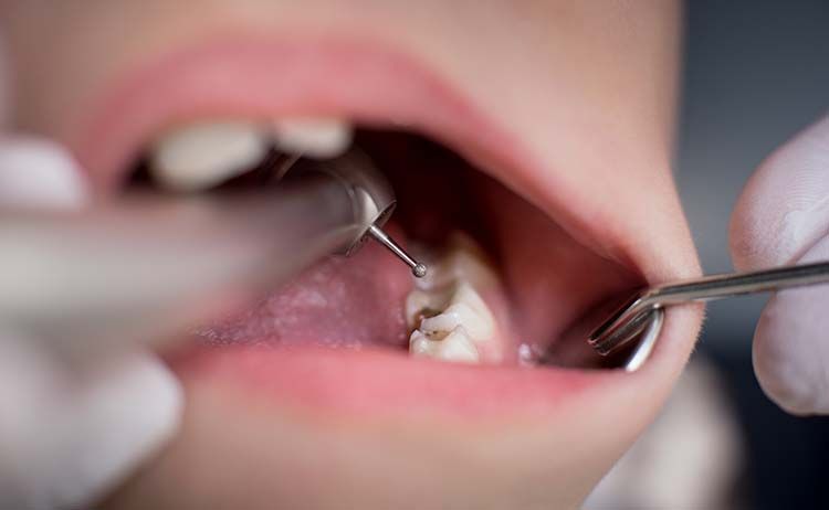 Restorative Dentistry