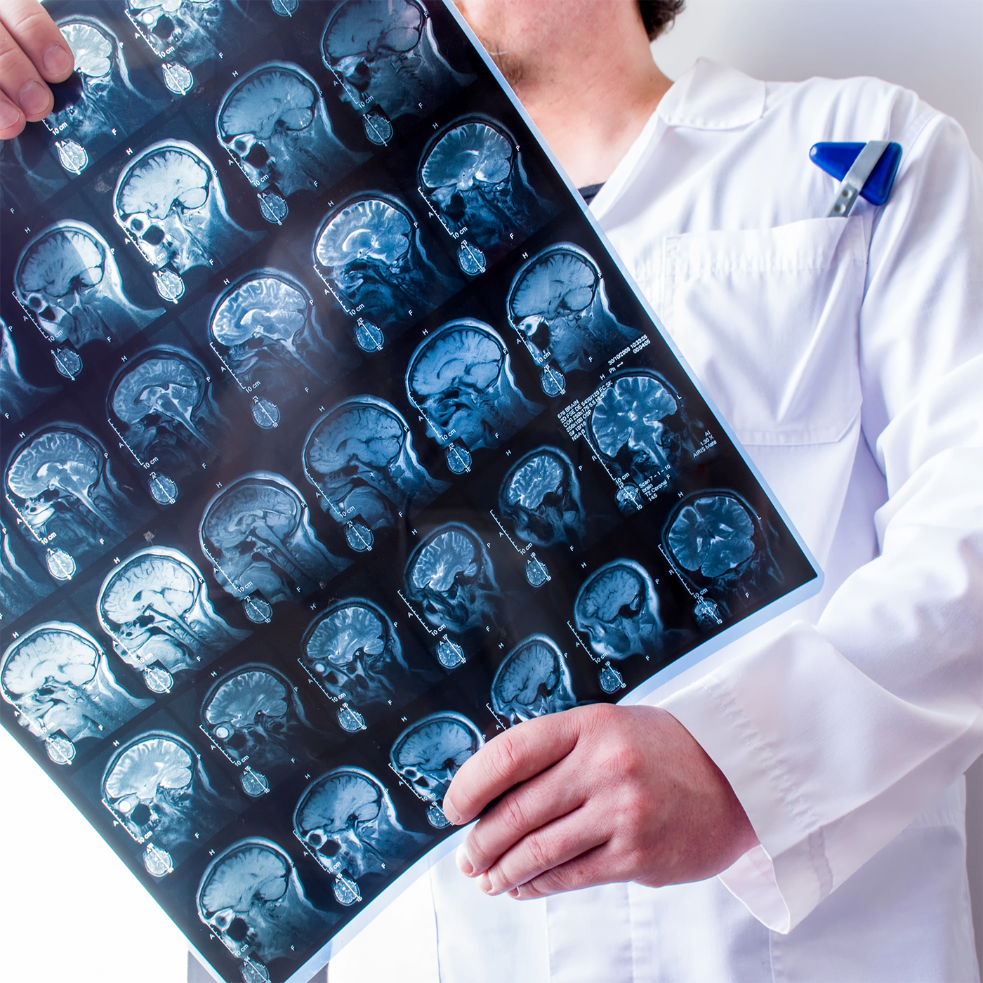 Doctor holding a brain scan film with multiple blue MRI images