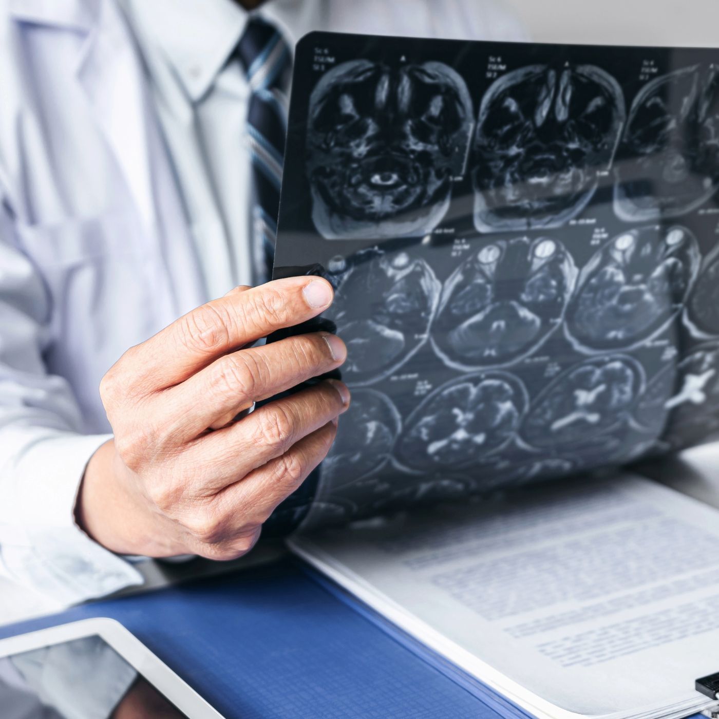 Doctor holding brain scan films over a desk with medical documents