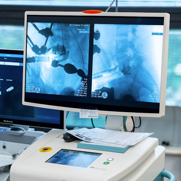 Medical monitor displaying X-ray images in a clinical setting