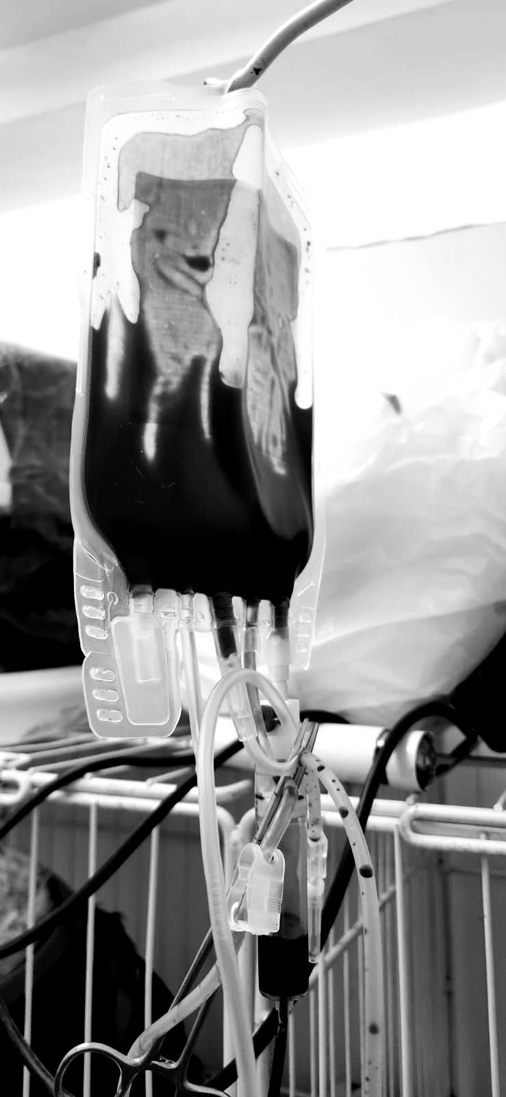 Una bolsa de sangre colgando de un soporte, probablemente en un entorno médico.