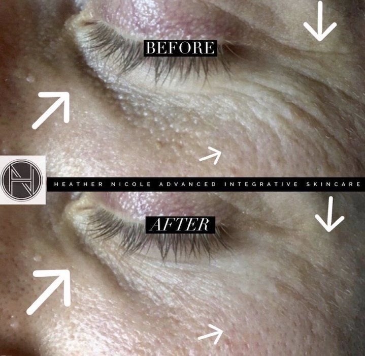 A before and after photo of a woman 's face