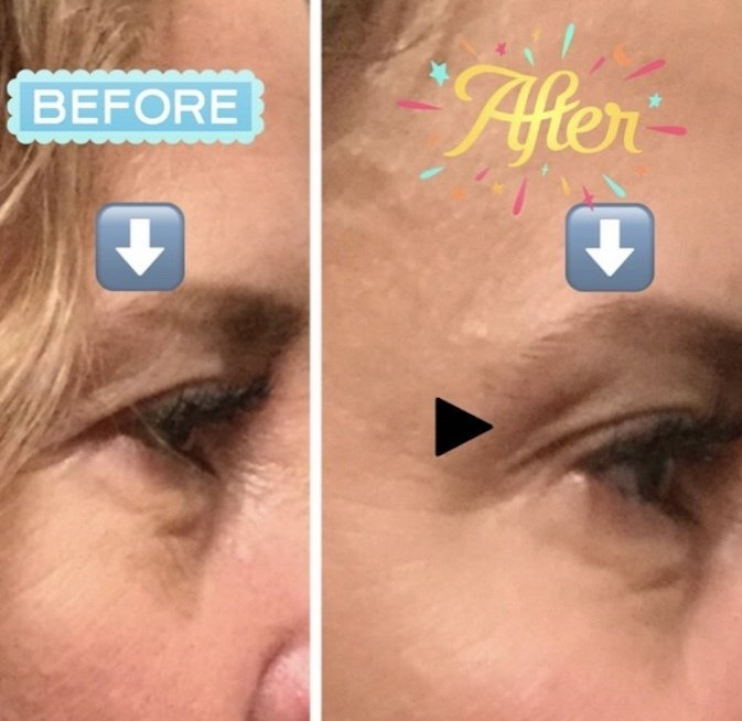 A before and after photo of a woman 's face