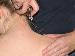 Behandlung mit Spray im Nacken