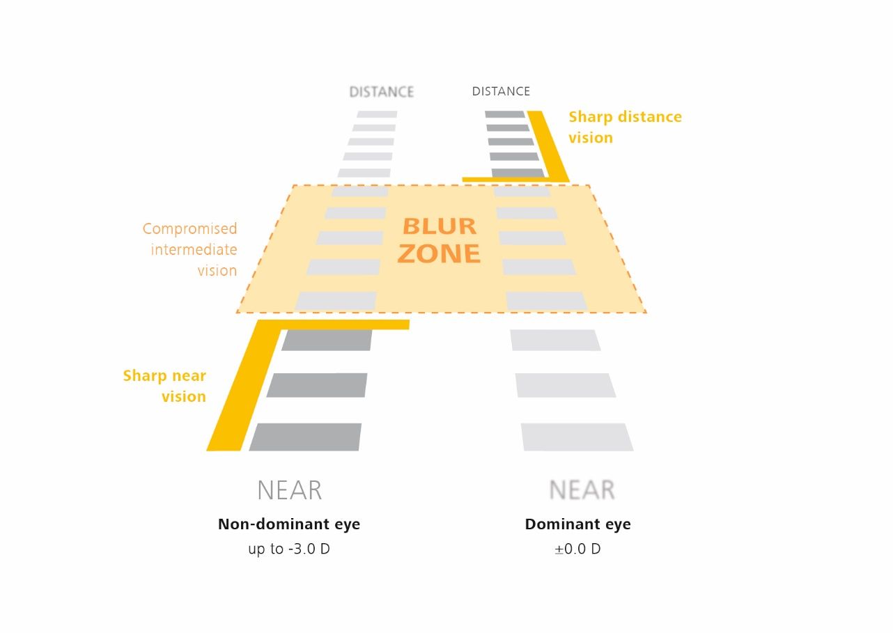 Visual representation of blur zones