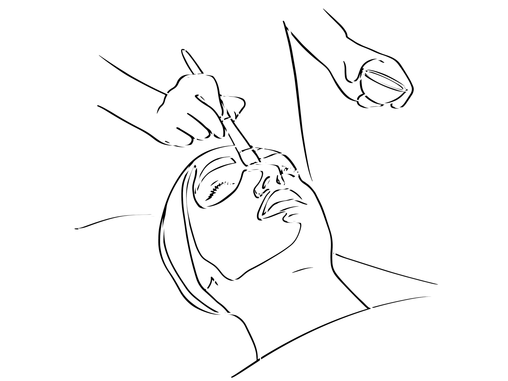 Peels