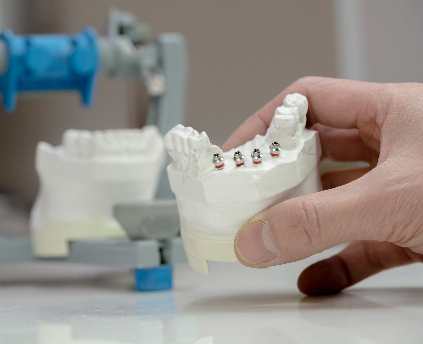 Dental implant model | Hobart, TAS | Total Denture Care Clinics
