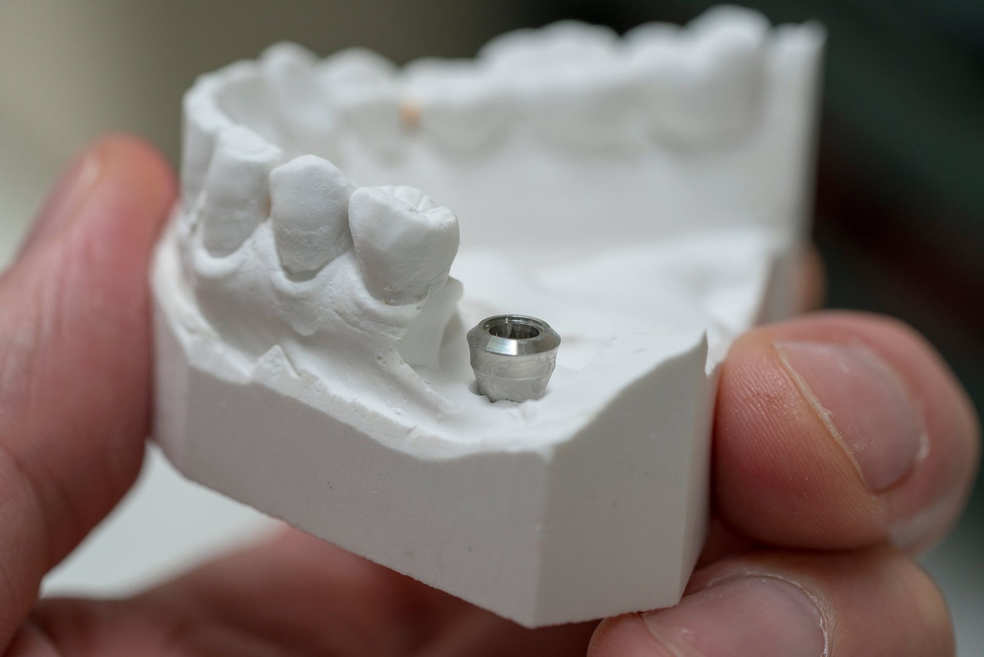 A Dental Technician Holding a Model of A Dental Implant | Hobart, TAS | Total Denture Care Clinics