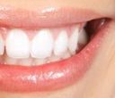 Primo piano di una bocca sorridente con denti bianchi e brillanti e labbra rosa.
