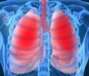 Polmoni evidenziati in rosso all'interno di un torso umano scheletrico blu, a indicare una potenziale difficoltà respiratoria o infezione.