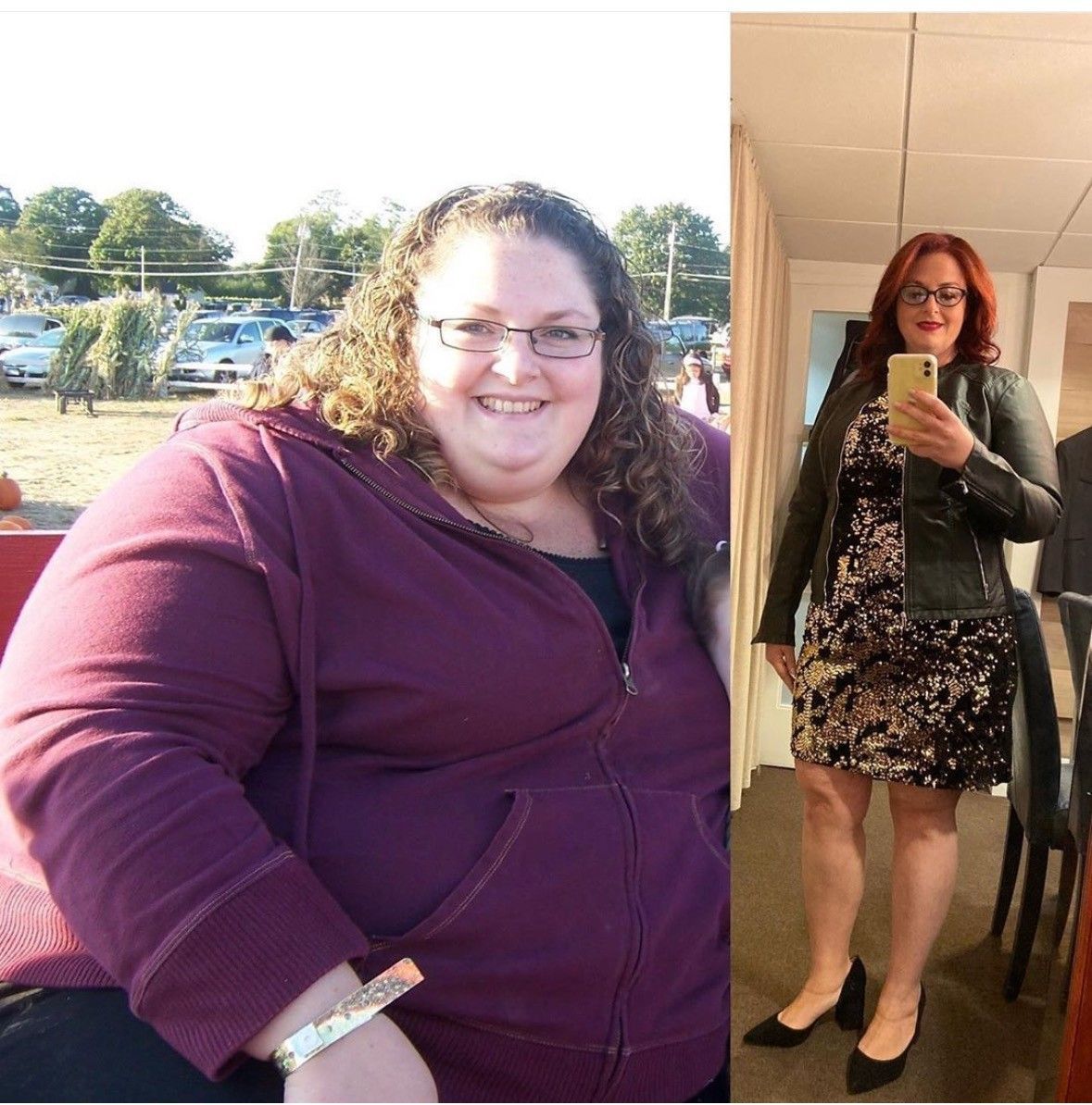 Side-by-side photos of a woman before and after weight loss. She's smiling and larger in a purple sweatshirt, then slim in a dress and jacket.