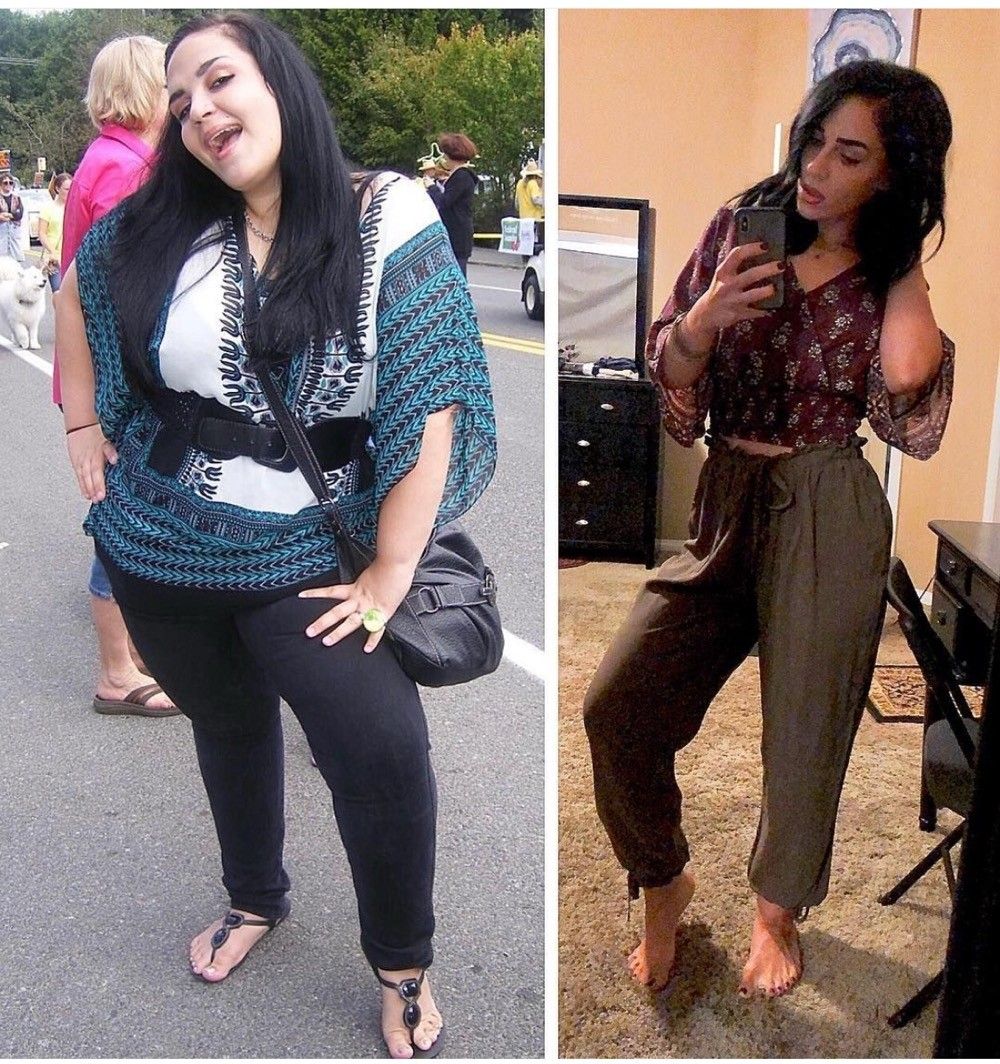 Woman before and after weight loss, wearing different outfits, indoors and outdoors.
