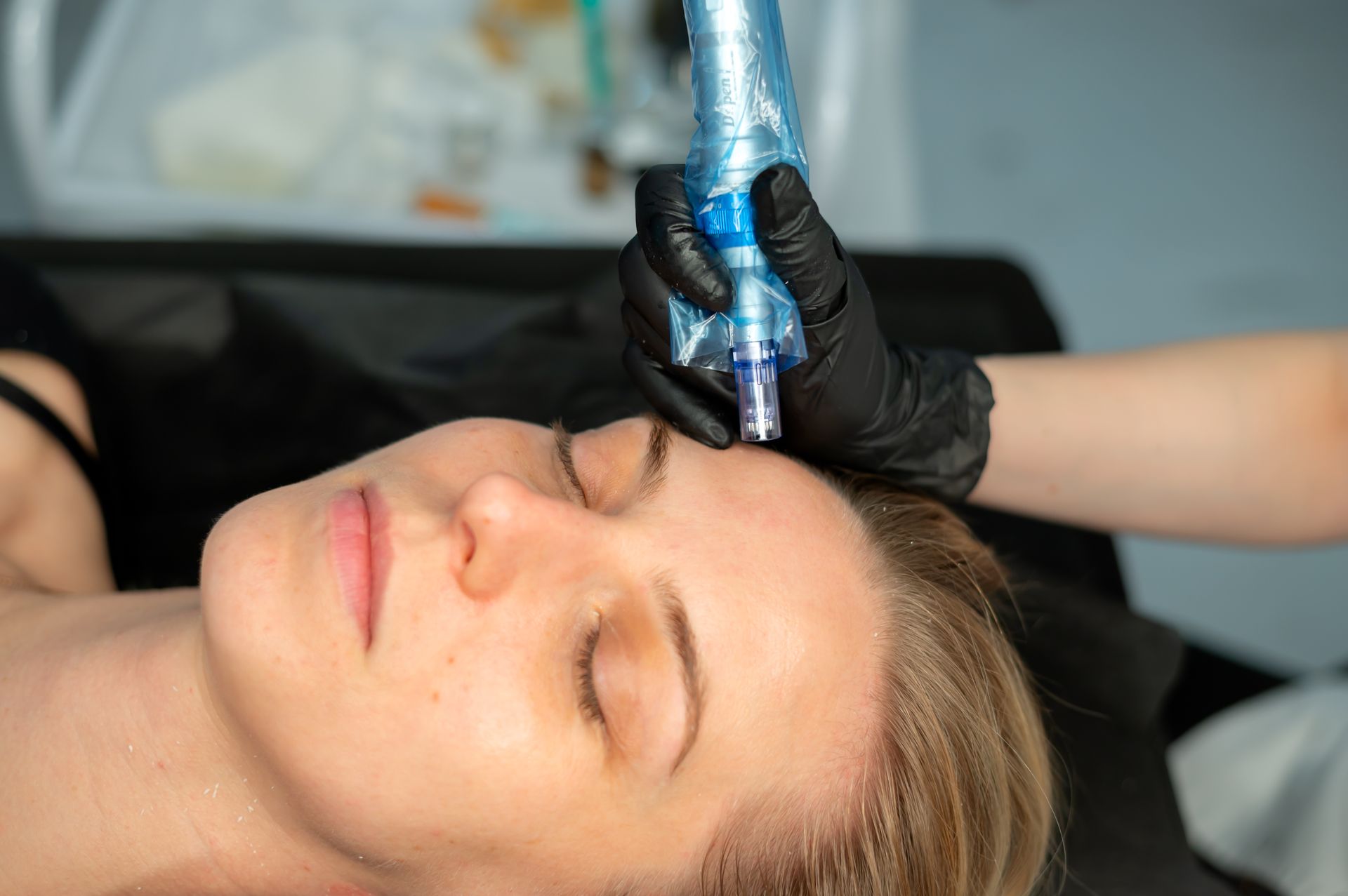 Cosmetologist performing a microneedling treatment on a client