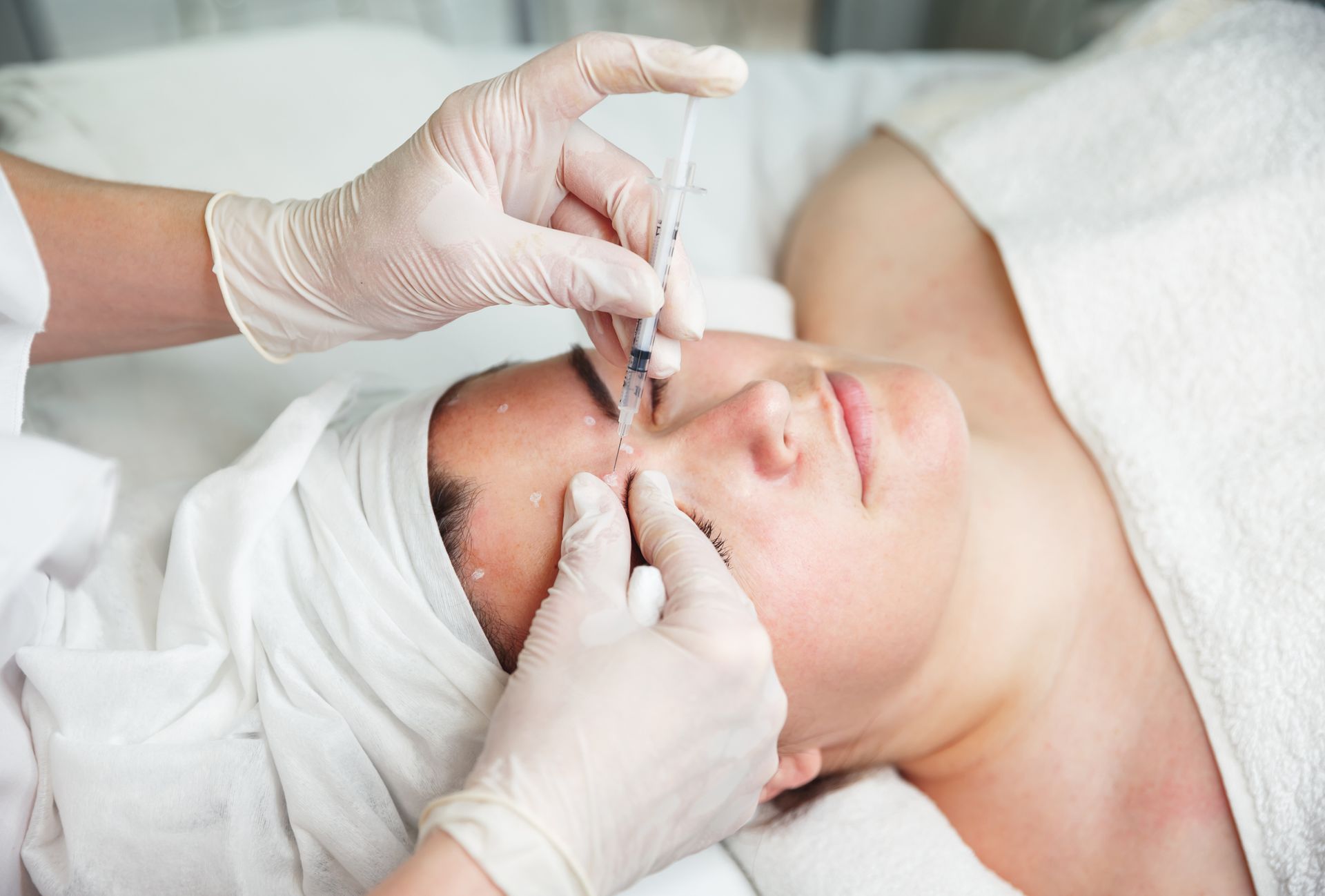 Botox treatment in progress on a woman to reduce wrinkles and achieve a youthful appearance.