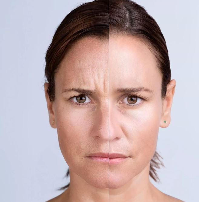Split-face comparison: woman with wrinkles on the left side, smoother skin on the right side.