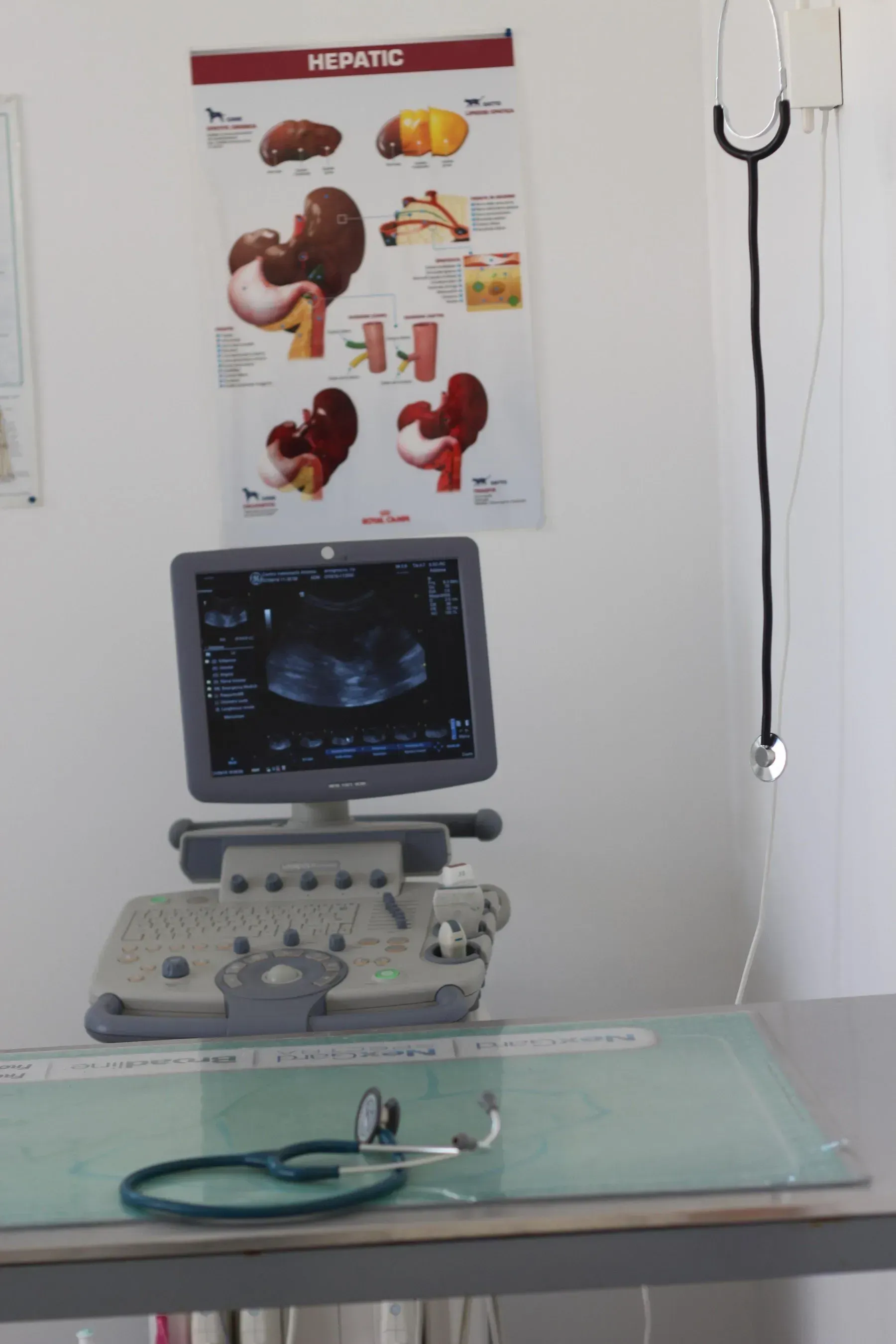 Un apparecchio per ecografie e una cartella clinica relativa al fegato all'interno di una sala per visite mediche.