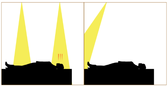 Positionierung von Einbauspots über Liegeflächen Schwarze Silhouette eine liegenden Person unter Spotstrahlen vor einem einfachen weißen Hintergrund (geteilte Grafik).