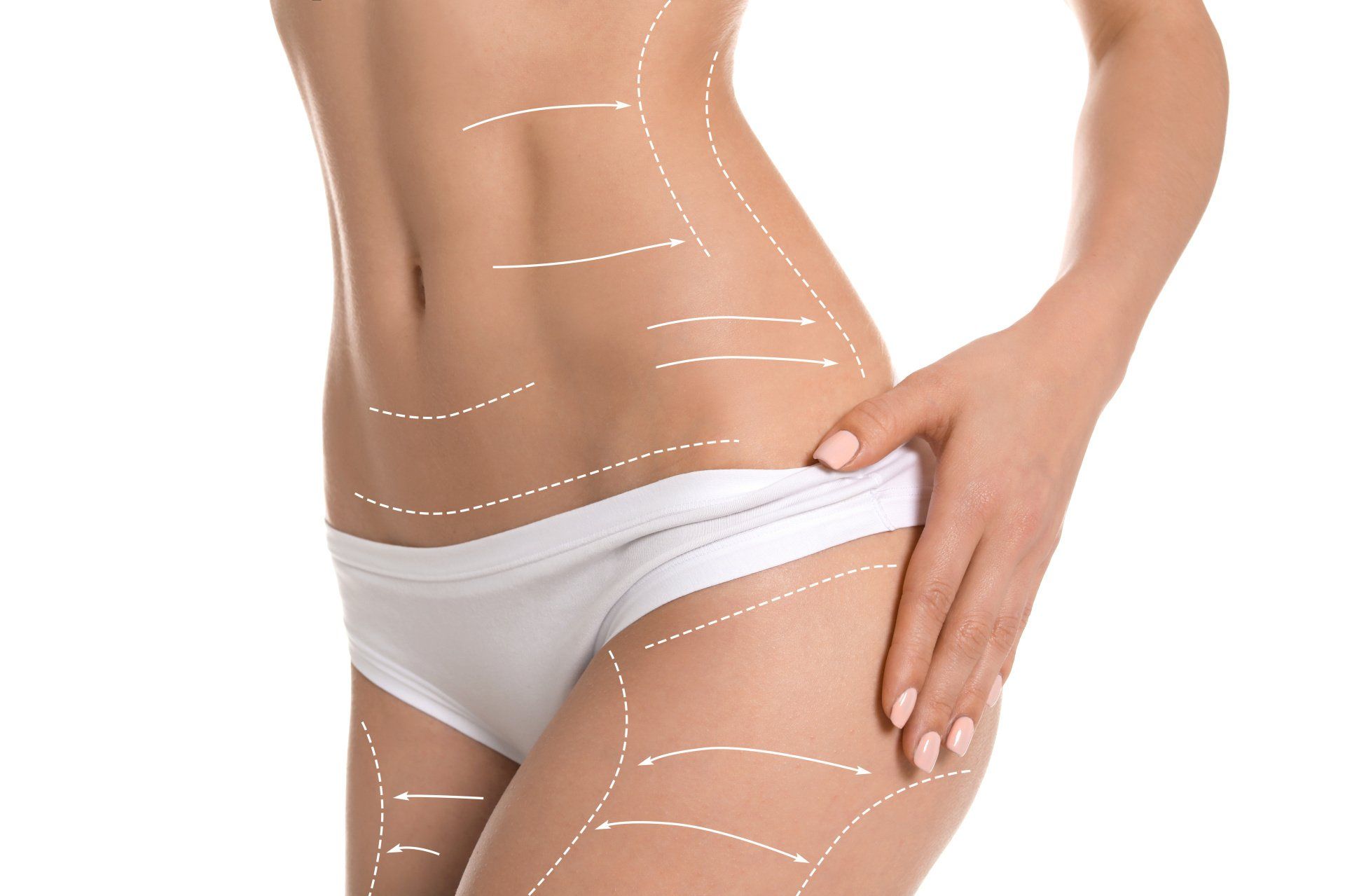 Una mujer en ropa interior blanca tiene líneas dibujadas en el estómago y las piernas.