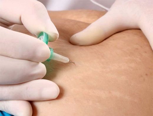 Una mujer está siendo examinada por un cirujano en un quirófano.