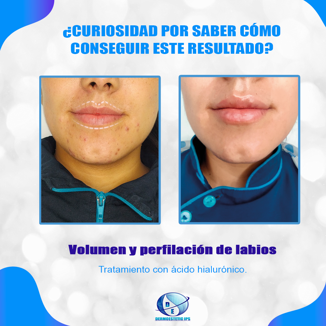 Una fotografía de antes y después de la cara de una mujer.