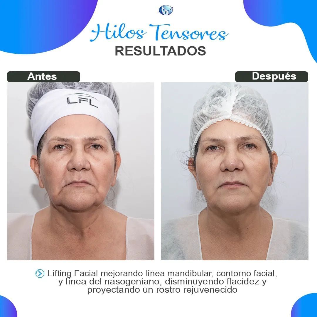 Una foto de antes y después de la cara de una mujer.