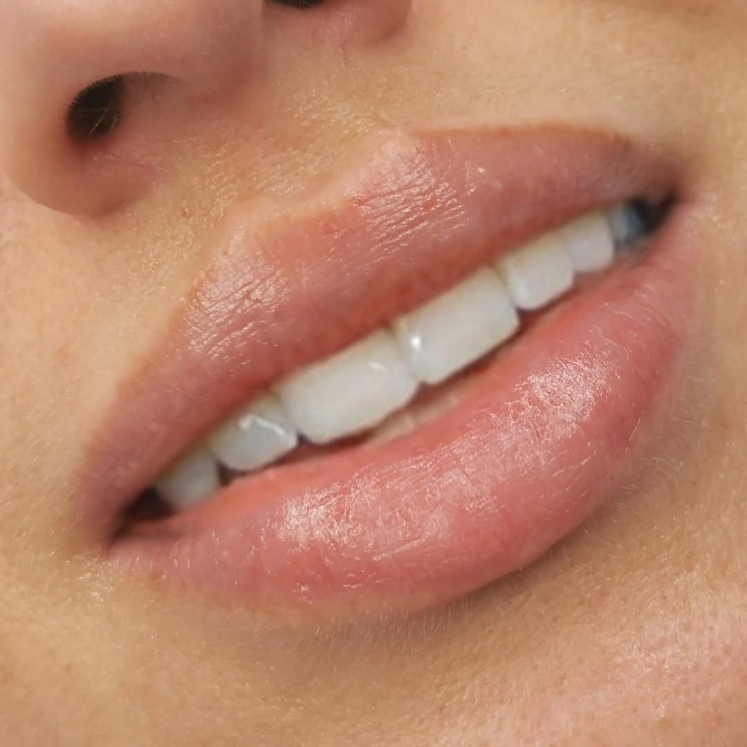 Rep Lips Dr Paul | Anti-Wrinkle & Aesthetic Treatments Wexford