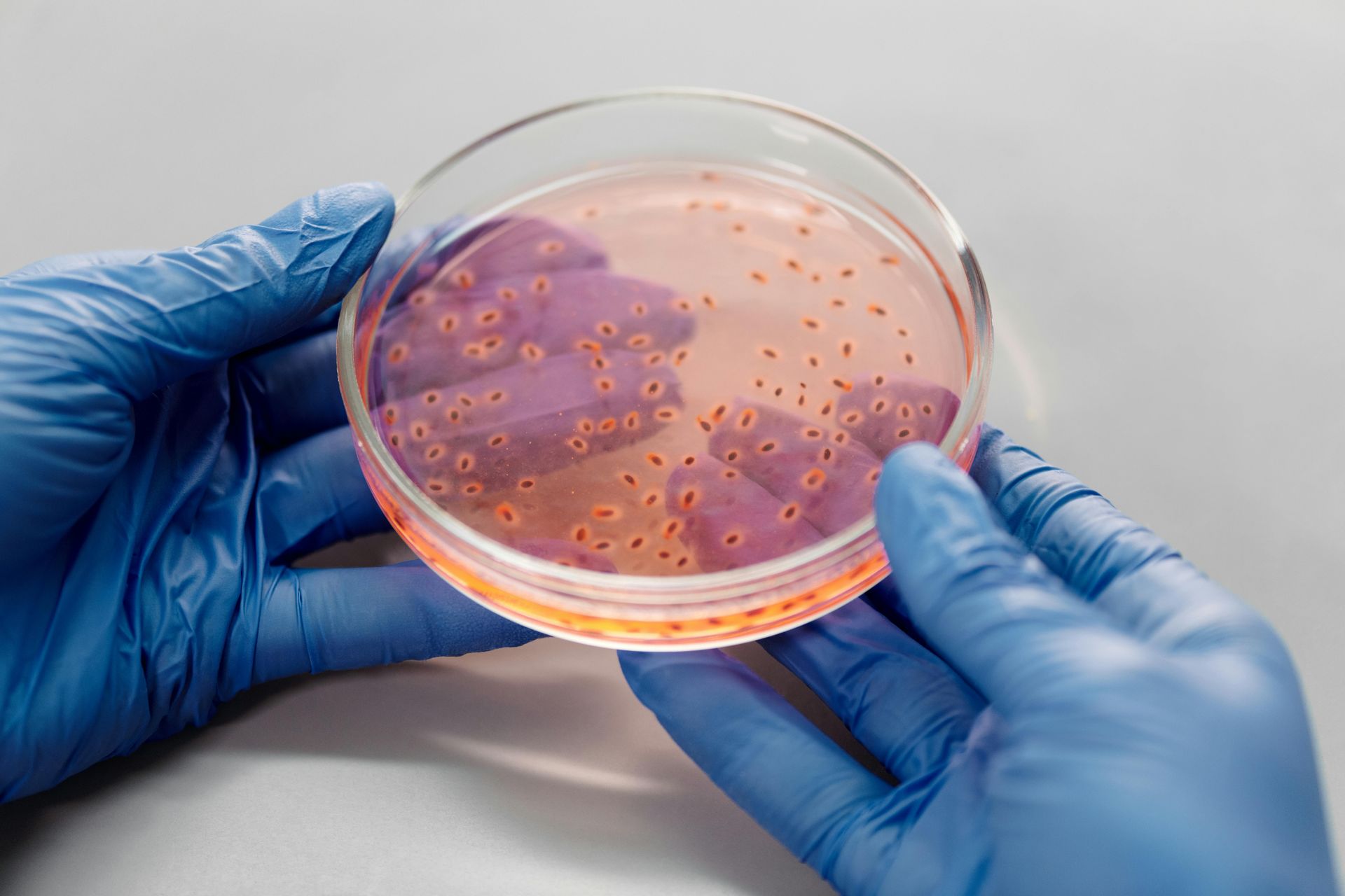 Hands in blue gloves holding petri dish with orange colonies.