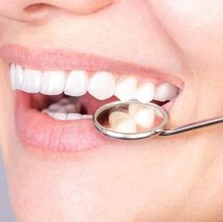 Une femme se fait examiner les dents avec un miroir dentaire.