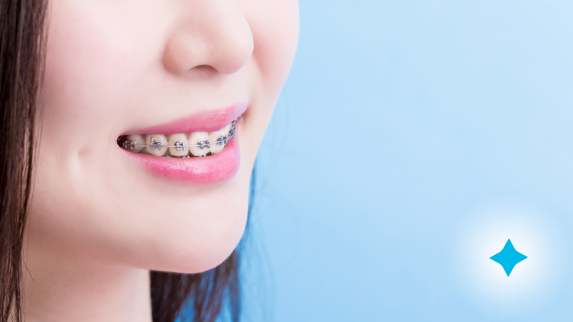 A close up of a woman 's face with braces on her teeth.