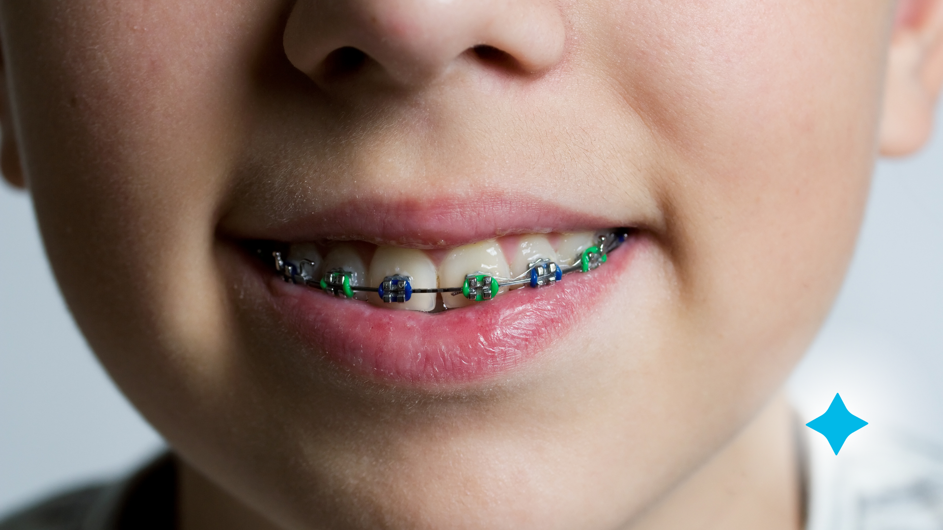kids smiling with braces