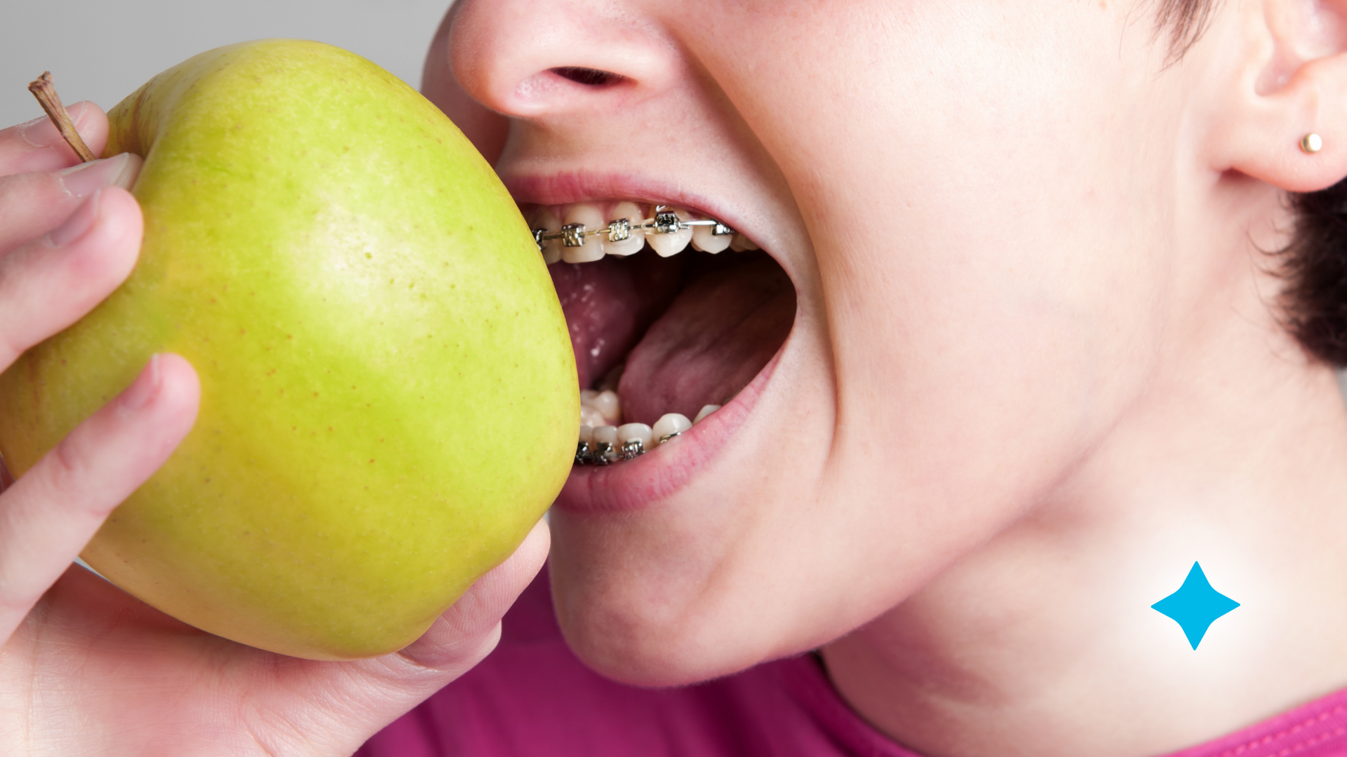 A person with braces on their teeth is eating an apple.