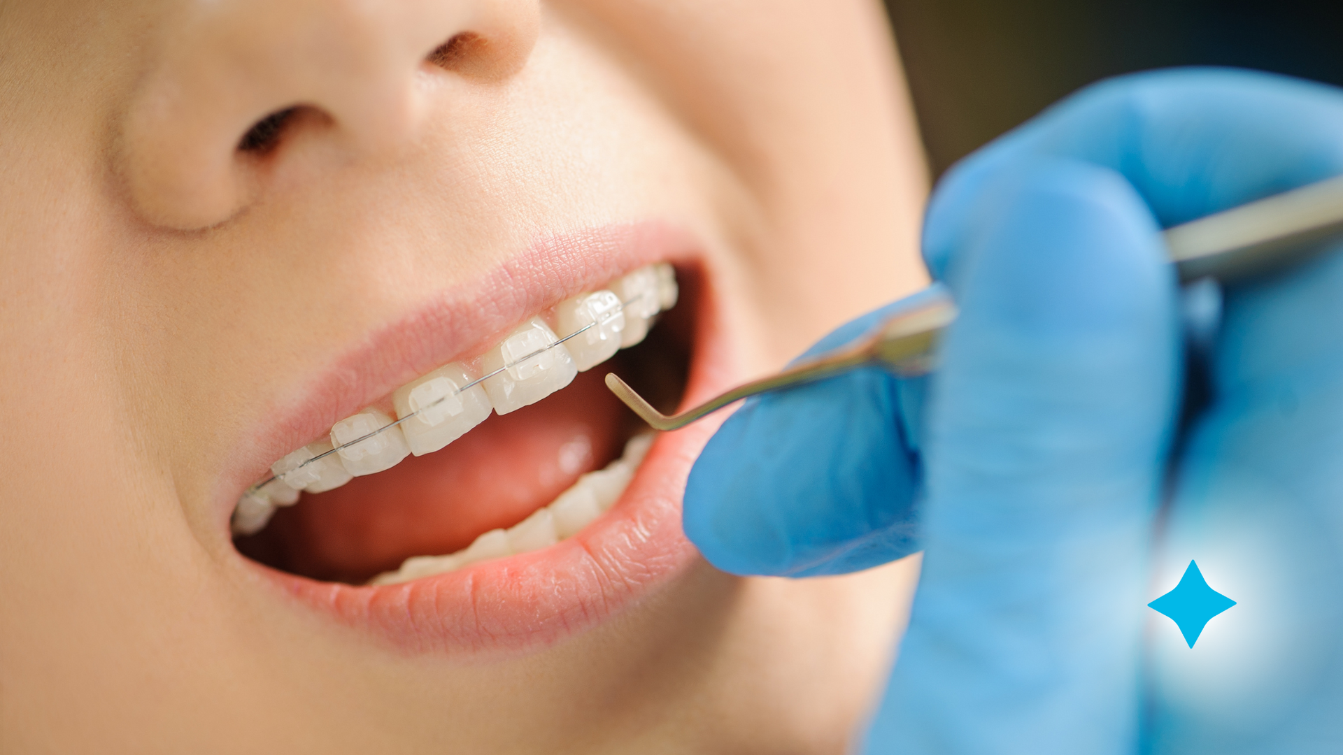 A woman with braces is getting her teeth examined by an orthodontist