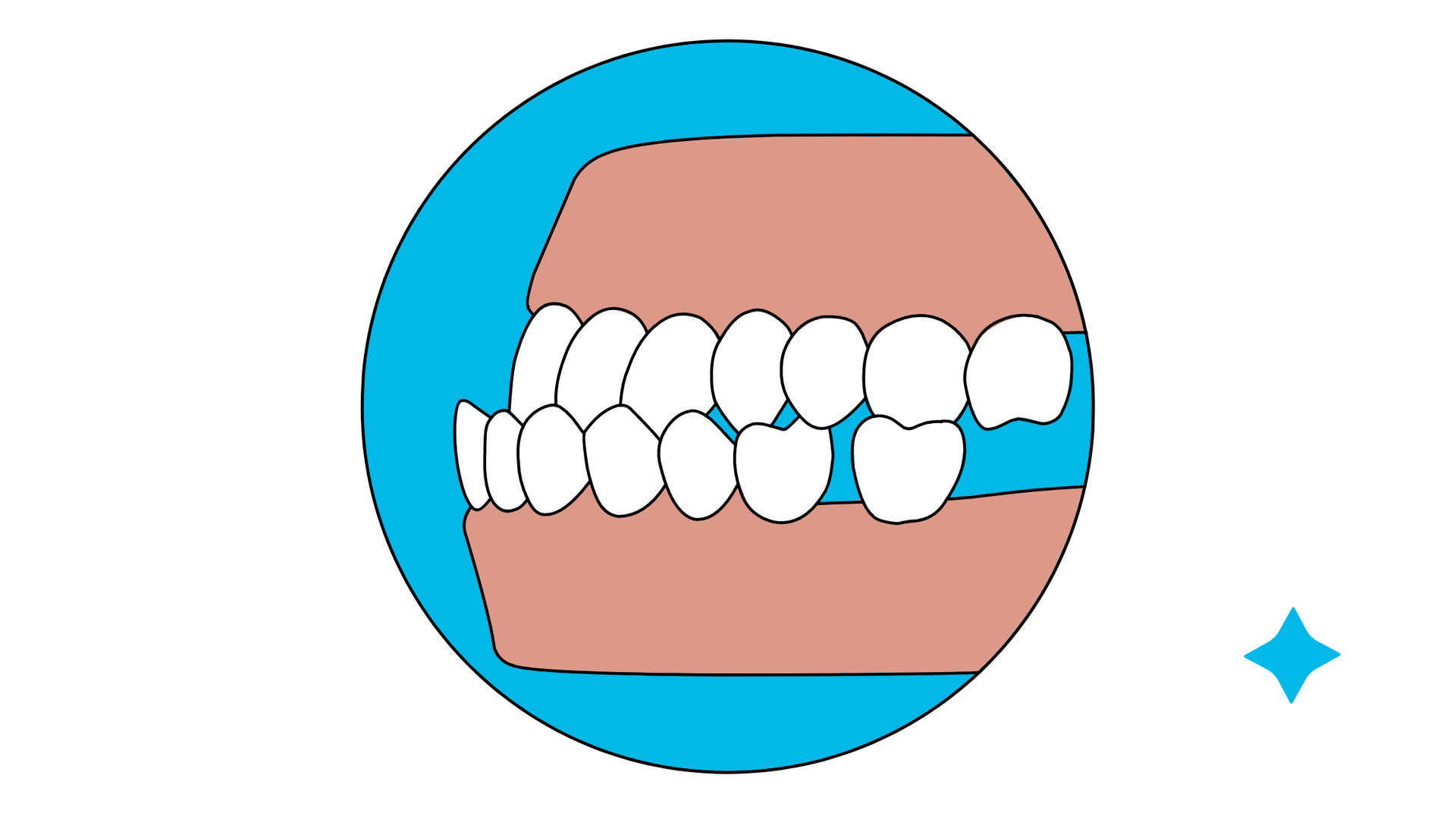 A cartoon drawing of a mouth with teeth in a blue circle.