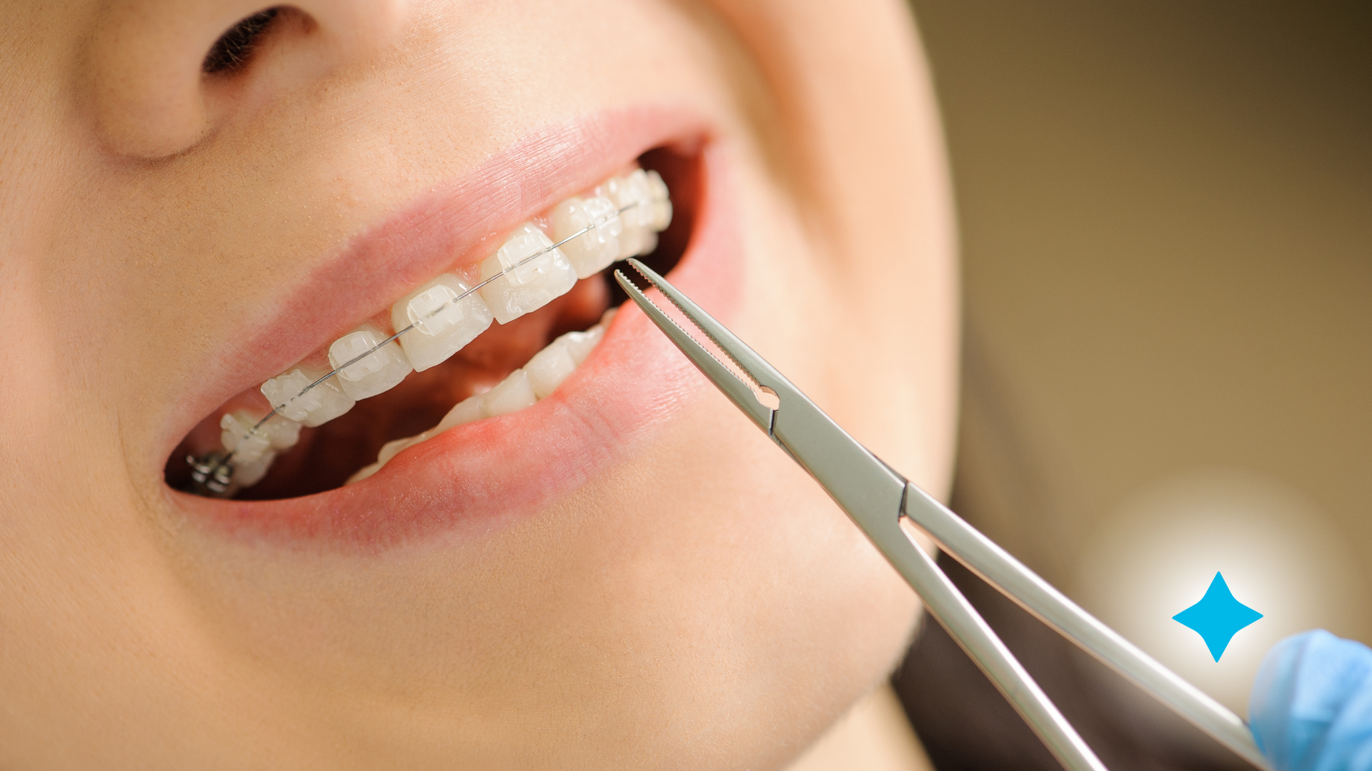 A woman with braces is getting her teeth examined by a dentist.