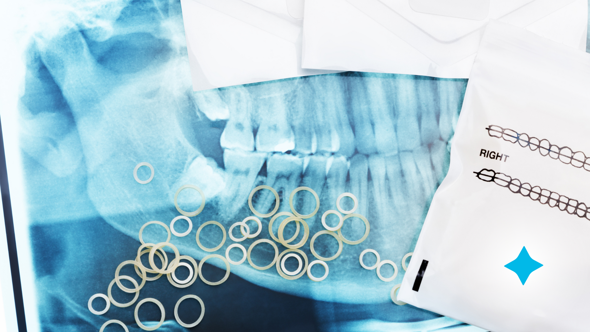 An x-ray of a person 's teeth is next to a piece of paper.