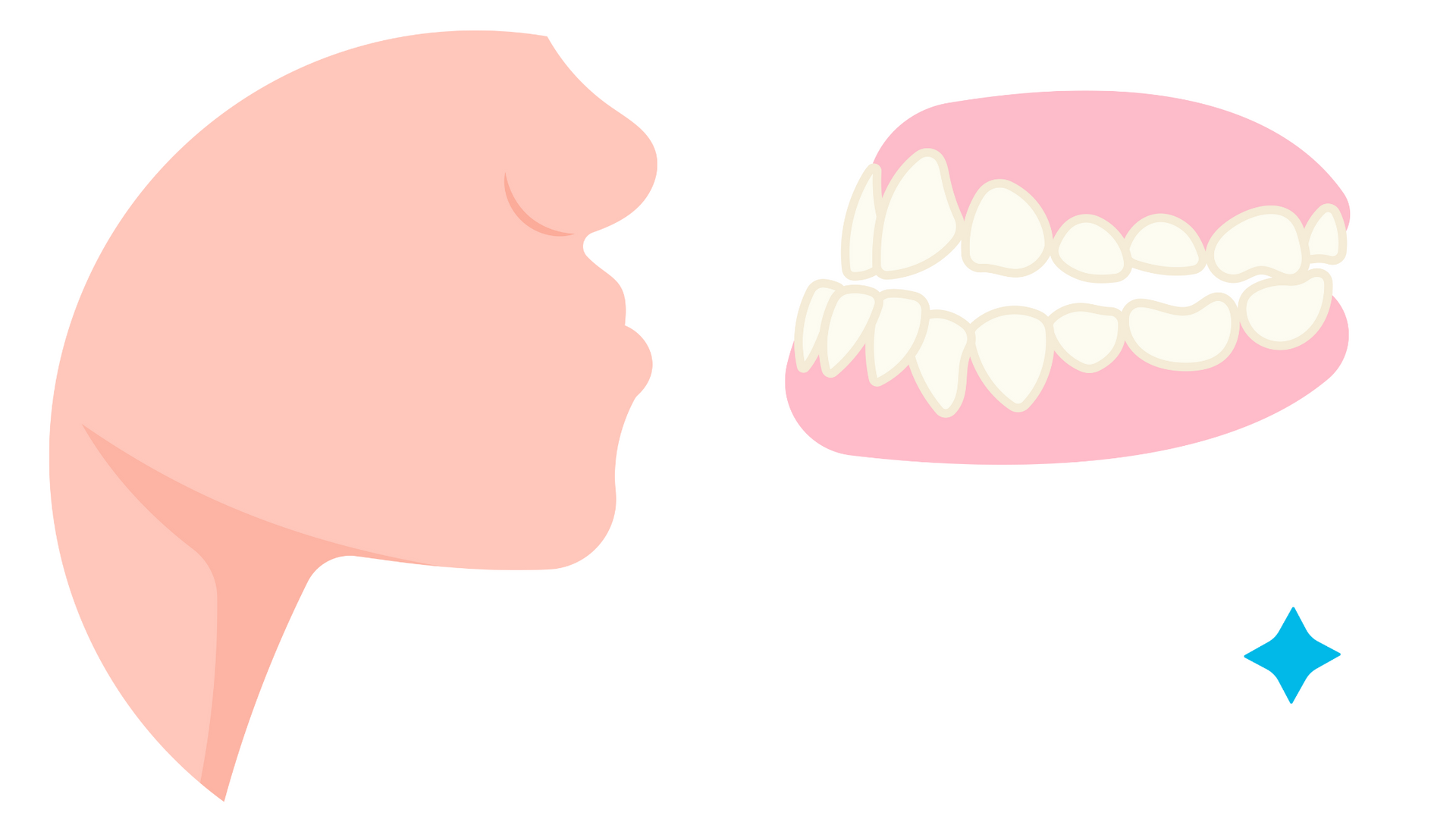 A cartoon illustration of a woman 's mouth and teeth.