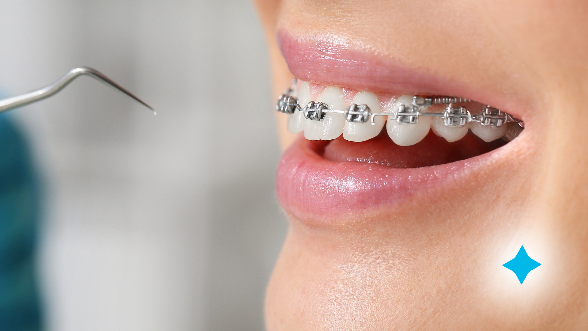 A woman with braces on her teeth is getting her teeth examined by a dentist.